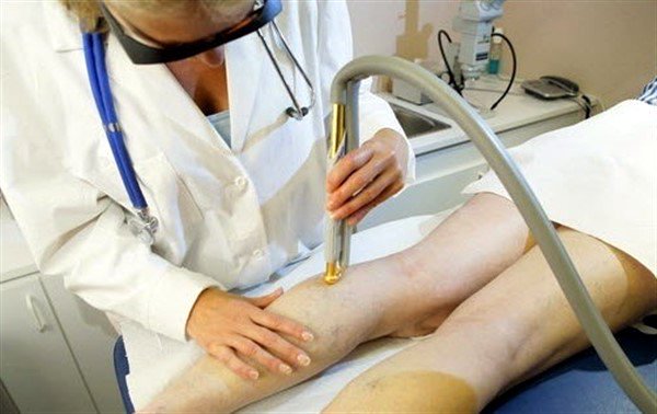 Диагностика и лечение тромбоза ног