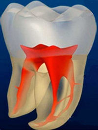 Схема здорового зуба