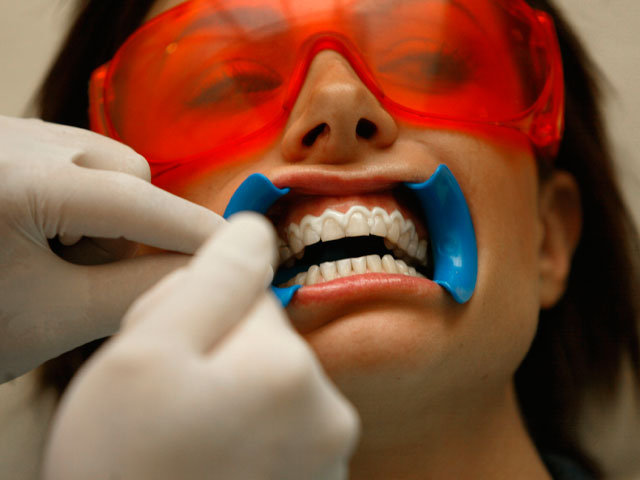 Отбеливание зубов крупным планом